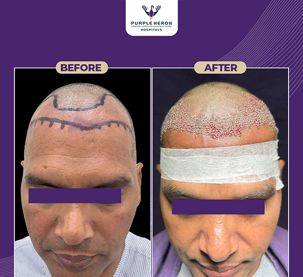 Plastic Surgery Patient of Dr. Lamoria