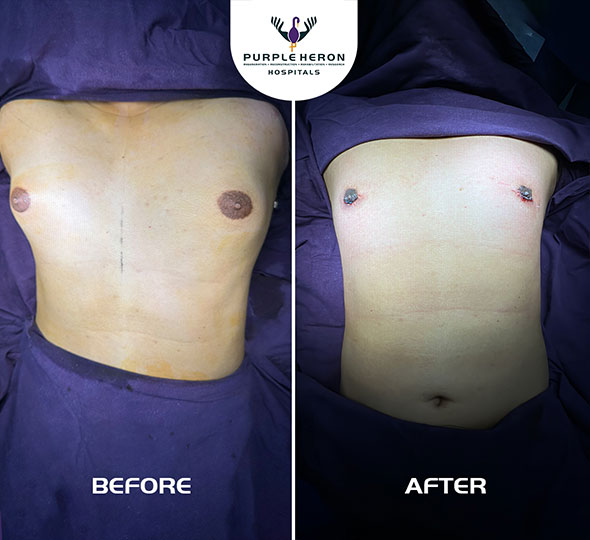 Plastic Surgery Patient of Dr. Lamoria